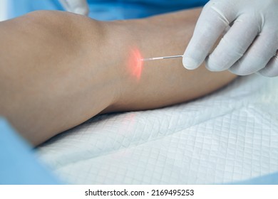 How are Varicose Veins and Spi..